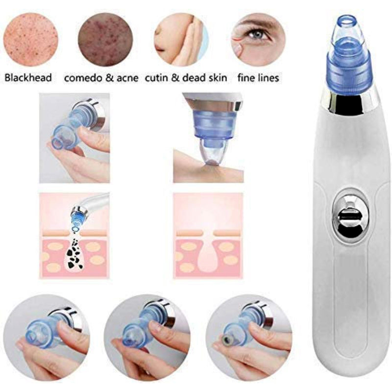 DermaSuction Vacuum Pore Cleaning Device