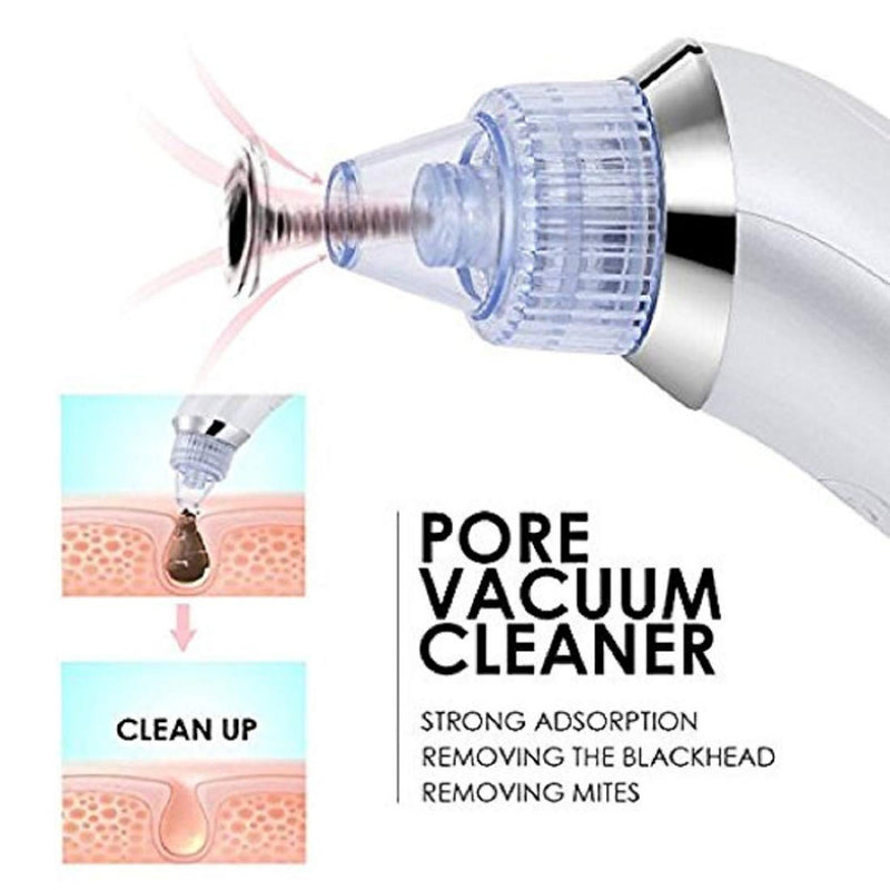 DermaSuction Vacuum Pore Cleaning Device